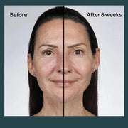 No7 Future Renew Damage Reversal Night Cream - Hydrating Face Moisturizer & Firming Cream to Reverse Visible Signs of Skin...