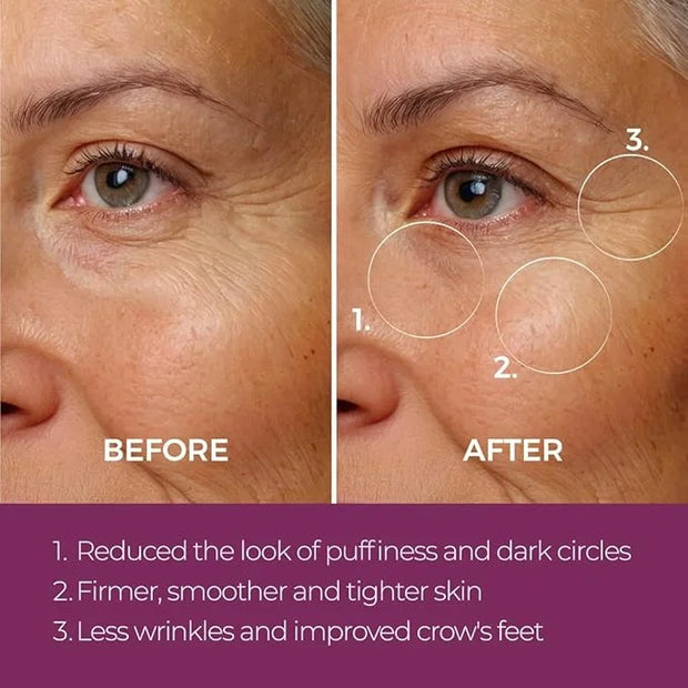 Blinc Eye Repair Peptide Complex | Clean, Vegan, Eye Cream | Anti-Aging, Anti-Wrinkle, Ultra Hydrating | Reduces Fine Line...