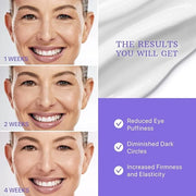 ESSENLIS Caffeine Eye Cream for Dark Circles and Puffiness, Bags Under Eyes, Collagen Anti Aging Day and Night Corrector f...