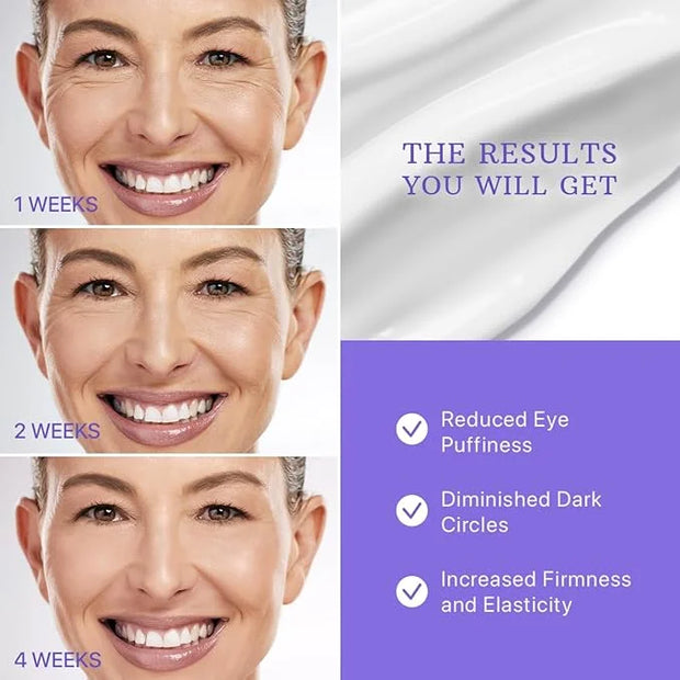 ESSENLIS Caffeine Eye Cream for Dark Circles and Puffiness, Bags Under Eyes, Collagen Anti Aging Day and Night Corrector f...