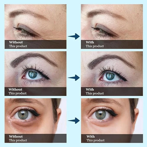 Under Eye Bags and Wrinkles, Wrinkle Filler, Eye Cream Visibly Reduces for Bags Under Eyes Bags Dark Circles Treatment - P...