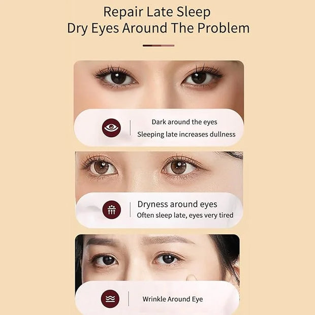 BLUE LOVE Anti-Aging Eye Cream – Reduces Dark Circles & Puffiness, Moisturizing Under-Eye Bags & Fast-Absorbing Wrinkle Tr...