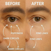 Disco Men's Eye Bag Treatment, Roller Serum for Men, Under Eye Cream Natural Caffeine Anti Aging Stick Balm, Reduce Puffin...