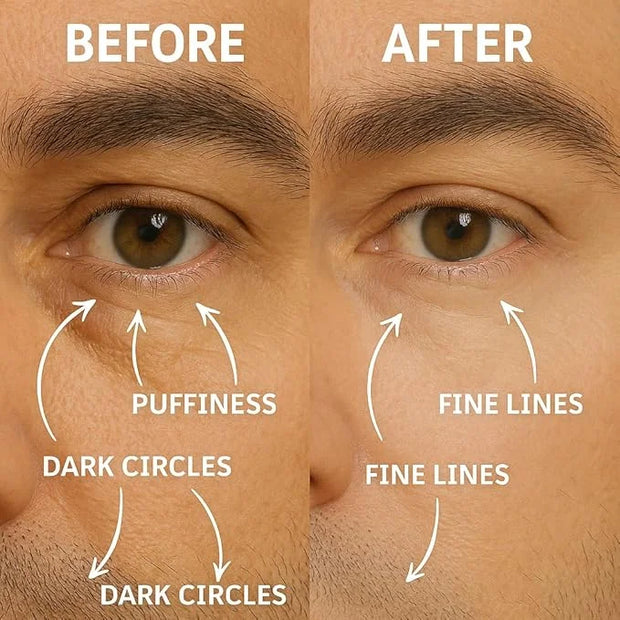 Disco Men's Eye Bag Treatment, Roller Serum for Men, Under Eye Cream Natural Caffeine Anti Aging Stick Balm, Reduce Puffin...