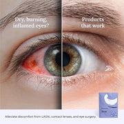 Rest: Self heating warm compress for dry eye | Heated eye Mask for fast relief | No microwave or washcloths needed | Trave...