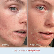 First Aid Beauty - Ultra Repair Cream, Intense Hydration Whipped Colloidal Oatmeal, Strengthens Skin Barrier in 7 Days & H...