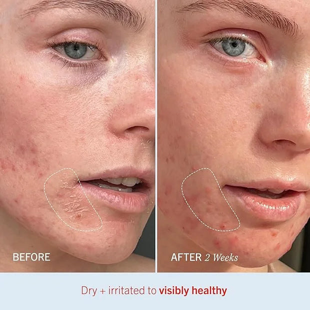 First Aid Beauty - Ultra Repair Cream, Intense Hydration Whipped Colloidal Oatmeal, Strengthens Skin Barrier in 7 Days & H...