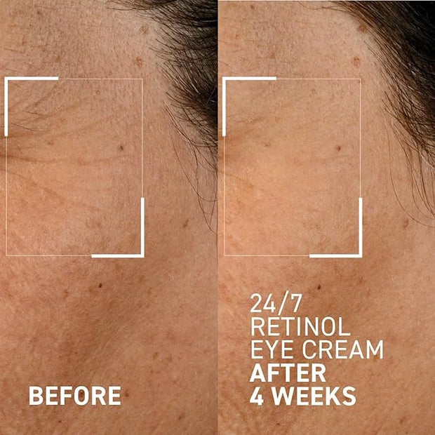 Dr. Brandt Bright This Way 24/7 Retinol Eye Cream - Smooths the Look of Fine Lines & Wrinkles, Illuminates & Moisturizes t...