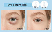 5% Caffeine Eye Serum, Anti-Aging Hydrating Eye Serum with 360° Massage Ball,Caffeine Eye Roller Reduce Wrinkles and Fine ...