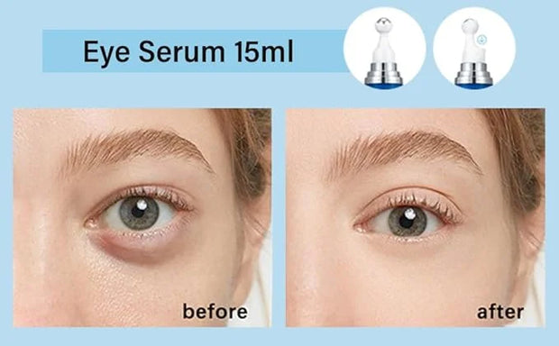 5% Caffeine Eye Serum, Anti-Aging Hydrating Eye Serum with 360° Massage Ball,Caffeine Eye Roller Reduce Wrinkles and Fine ...