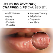 Natural Lip Balm For Very Dry Lips,