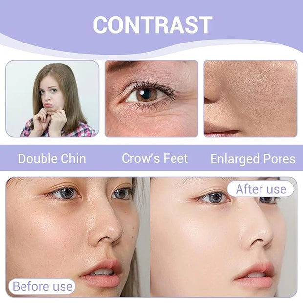 108PCS Smile Line Wrinkle Patches, Facial Frown Crows Feet Wrinkle Patches - Product Image