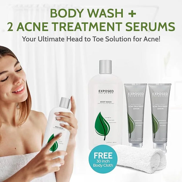 Exposed Skin Care Body Acne Kit – Dual Acne Treatment Serums + Body Wash and Exfoliating Body Cloth – Powerful System Elim...