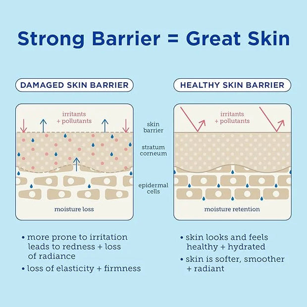 Skinfix Barrier+ Triple Lipid-Peptide Lotion: Lightweight, Hydrating Lotion To Help Rescue & Repair The Skin Barrier, 1.7 ...