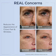 Plexaderm Rapid Reduction Eye Serum - Visibly Reduces Under-Eye Bags, Wrinkles, Dark Circles, Fine Lines & Crow's Feet Ins...