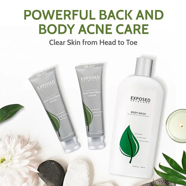 Exposed Skin Care Body Acne Kit – Dual Acne Treatment Serums + Body Wash and Exfoliating Body Cloth – Powerful System Elim...