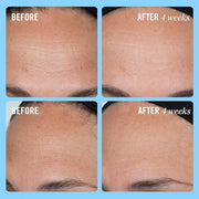 First Aid Beauty Firming Collagen Cream with Collagen, Peptides and Niacinamide – Day + Night Anti-Aging Face Moisturizer ...