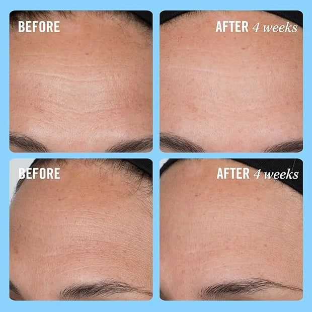 First Aid Beauty Firming Collagen Cream with Collagen, Peptides and Niacinamide – Day + Night Anti-Aging Face Moisturizer ...