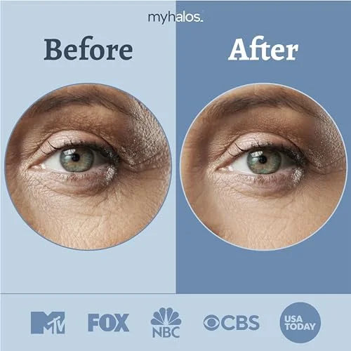 MyHalos Eye Masks for Dark Circles and Puffiness & Eye Patches for Wrinkles Duo- 24 Under Eye Patches for Puffy Eyes, Dark...