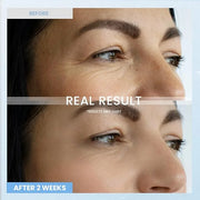 Retinol Eye Cream for Dark Circles: Anti-Wrinkle Under Eye Cream - Night Care Eye Cream Reduces Eye Bags - Product Image