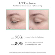 BIOEFFECT EGF Serum, Eye Serum, Eye Mask Skincare Set: Firming Favorites, with Barley Growth Factor - Product Image