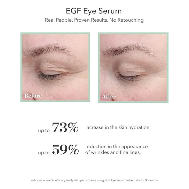 BIOEFFECT EGF Serum, Eye Serum, Eye Mask Skincare Set: Firming Favorites, with Barley Growth Factor - Product Image