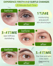 120 Pcs Chlorella Eye Patches,Collagen Under Eye Mask for Puffy Eyes & Dark Circles, Combat Fine Lines and Wrinkles,Non-Ir...