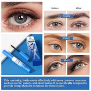 QIC Lash Serum - 4ml Eyelash Enhancing Serum, W3W Eyelash Serum for Eyelash Thicker, Stronger, Longer Suitable for Lashes ...