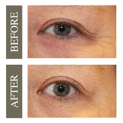 Hey Honey Open Your Eyes Lifting Eye Serum | Under Eye Cream for Dark Circles & Puffiness | Around The Eyes Hydration | Su...