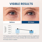 5% Caffeine 5% Retinol Eye Cream for Dark Circles, Puffiness and Bags, Hyaluronic Acid and Niacinamide Under Eye Cream Ant...