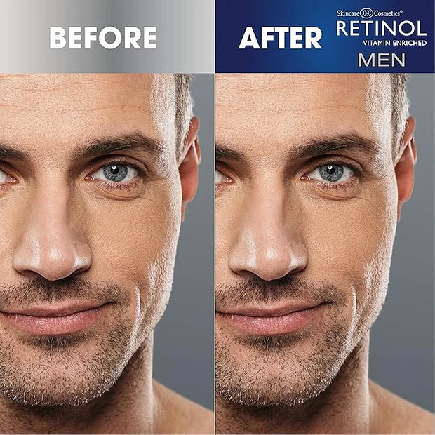 Retinol Men Eye Cream Reduces Puffiness & Dark Circles, Boost Hydration & Minimize Visible Signs Of Aging Men Facial Serum...