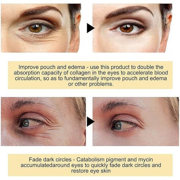 24K Gold Under Eye Patches - Hydrating Anti-Wrinkle Masks with Hyaluronic Acid, Vitamin C - Reduce Dark Circles, Puffiness...