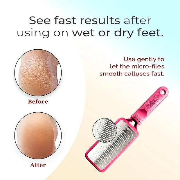 Microplane Colossal Foot File Scraper - The Original Stainless Steel Foot Rasp, Dead Skin/Callus Remover for Feet, Gentle ...