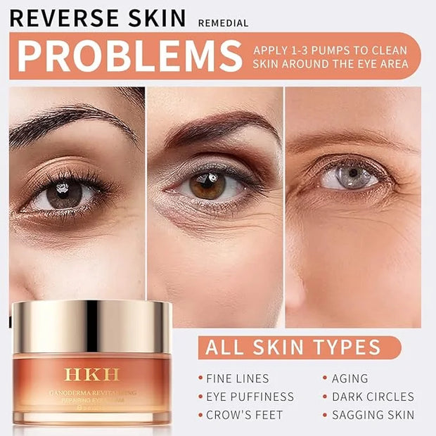 Dark Circles Under Eye Treatment for Women - Eye Cream for Dark Circles Wrinkles Puffiness & Fades Fine Lines, Fade Dark C...
