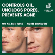 Mens 4-Piece Skin Kit for Clearer Skin, Targets Blemishes, Vegan Formula with Daily Face Wash, Clarifying Toner, Purifying...