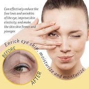 Eye Roller for Puffy Eyes, Castor Oil and Frankincense Eye Roller for Dark Circles, and Wrinkles, Anti Aging Eye Serum Cre...