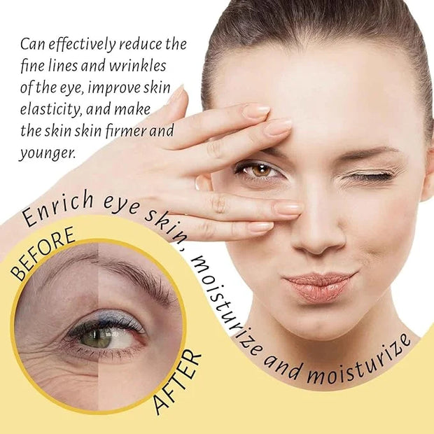 Eye Roller for Puffy Eyes, Castor Oil and Frankincense Eye Roller for Dark Circles, and Wrinkles, Anti Aging Eye Serum Cre...