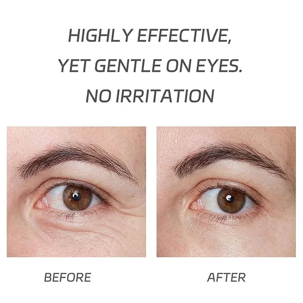 VGO Vitamin C Vitamin E Facial Serum 2.02oz + Eye Repair Cream for Dark Circles & Puffiness 0.5oz - Product Image