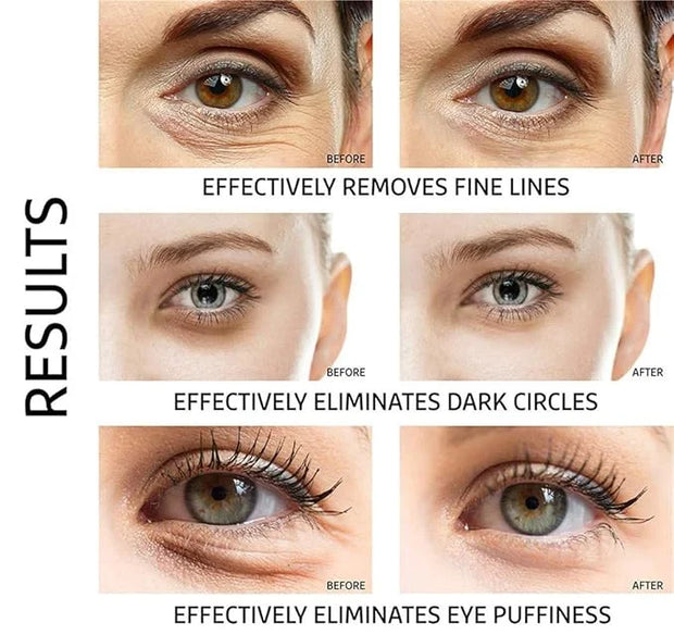 Under Eye Patches - 30 Pairs Collagen Eye Mask Eye Patches for Puffy Eyes and Dark Circles, Gel Under Eye Mask, Black - Pr...