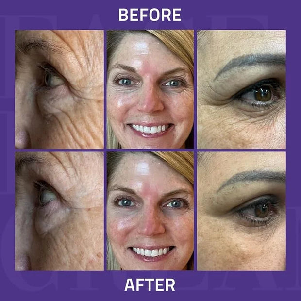 YEOUTH Instant Face Lift Cream, Temporary Skin Tightening Under Eye Cream for Women, Tightening and Lifting Concealer 15ml...