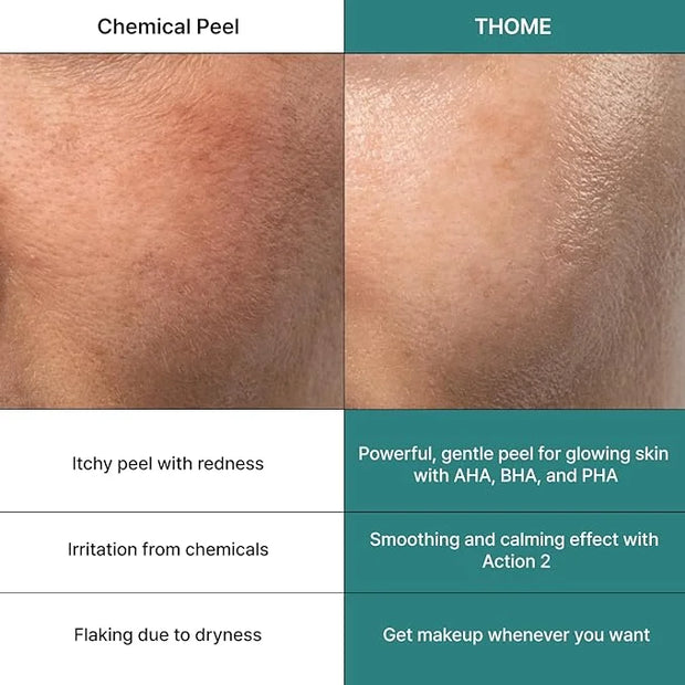 THOME Glow Sealer Mask Refill Set | 6 Sheets of Ultra-high Hydration for Chemical G-Peel at home - Product Image