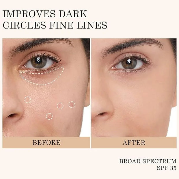 KYDA Mineral Sunscreen Eye Cream, 3-in-1 Anti-Aging Eye Cream, SPF 35, for Dark Circle and Fine Lines, Medium - Product Image