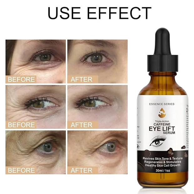 Caffeine Eye Serum - with EGCG, Vitamin C, Hyaluronic Acid, Collagen, Caffeine Eye Lift Serum - Reduces Puffiness, Dark Ci...