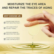 MOND'SUB Premium Under-Eye Mask with Collagen and Hyaluronic Acid for Dark Circles, Puffiness, and Eye Bags - Avocado Mois...
