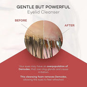 ZocuFoam Eyelid Cleanser - Foaming Eyelid Scrub - Natural pH Balanced Solution - 1.7 FL OZ (50mL) - Product Image