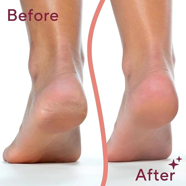 Finishing Touch Flawless Pedi Electronic Tool File and Callus Remover, Pedicure-New Version (Amazon Exclusive) - Product I...