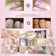 2pcs Herbal Nail Treatment Essence,Rosabelle