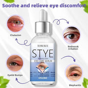 Stye Eye Treatment, Natural Relief Drops Serum for Styes Chalazion and Blepharitis, Fast Chalazion Remover for Restore Hea...