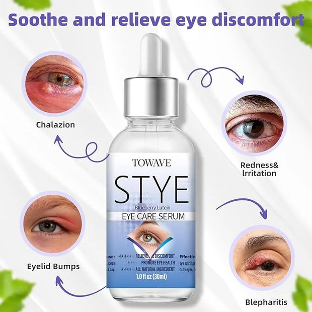 Stye Eye Treatment, Natural Relief Drops Serum for Styes Chalazion and Blepharitis, Fast Chalazion Remover for Restore Hea...
