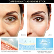 Caffeine Eye Cream for Dark Circles: Caffeine Under Eye Stick - Smooth Fine Lines Hydrate Eye Contour - Product Image